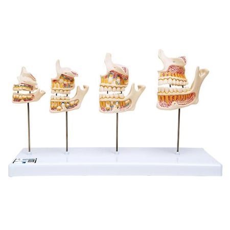 Dentition Development - W/ 3B Smart Anatomy